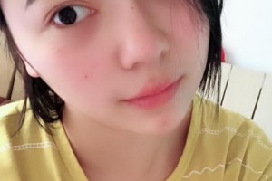 贛州韓美整形美容醫(yī)院鐘發(fā)奎整形價(jià)格表附隆鼻案例展示