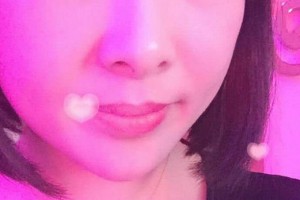 贛州啟明星眼科醫(yī)院郭年波整形價格表附雙眼皮案例展示