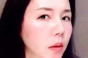 贛州衛(wèi)華口腔醫(yī)院巫資雄整形價格表附牙綜合案例展示