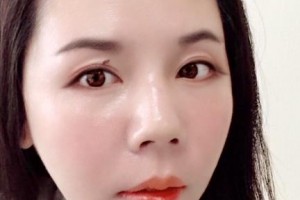 贛州維樂口腔門診部郭丹整形價格表附牙綜合案例展示