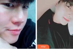 宜春愛爾眼科醫(yī)院蘭麗霞整形價格表附眼部綜合案例展示