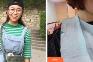 上饒維樂陽光口腔門診部楊唐文整形價格表附牙齒陶瓷矯正案例展示