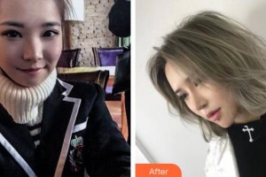 烏魯木齊黎美整形門診部王桃花整形價(jià)格表附自體軟骨墊鼻尖案例展示