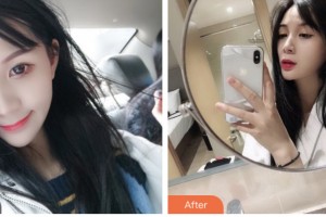 昆山百達(dá)麗醫(yī)療美容門診部劉瑩整形價格表附光子嫩膚案例展示