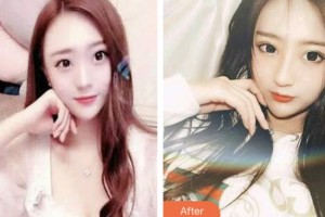 昆山益達(dá)口腔門診部萬東元整形價(jià)格表附超聲波潔牙案例展示