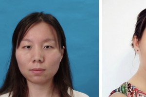 鹽城東方婦產(chǎn)醫(yī)院整形美容中心方長亮整形價(jià)格表附切開雙眼皮案例展示