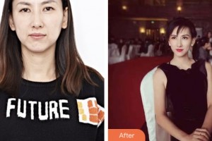 荊門市第一人民醫(yī)院醫(yī)學美容中心李薇薇整形價格表附超聲提拉案例展示