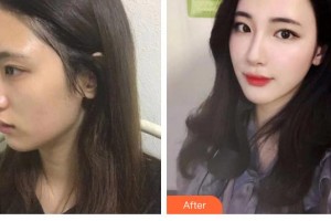 泰州麗都醫(yī)療美容醫(yī)院李麗杰整形價(jià)格表附鼻部綜合案例展示