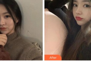 泰州麗都醫(yī)療美容醫(yī)院周入仁整形價(jià)格表附鼻部綜合例展示