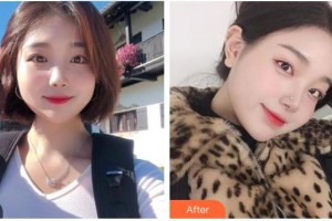 泰州麗都醫(yī)療美容醫(yī)院許俊平整形價(jià)格表附耳軟骨復(fù)合隆鼻案例展示