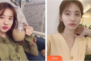 湘潭市中心醫(yī)院醫(yī)學(xué)整形美容科李為儒整形價格表附鼻部綜合案例展示