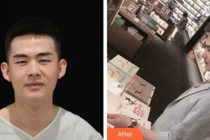 永州市皮膚病醫(yī)院醫(yī)療美容科呂朝俊整形價(jià)格表附鼻部綜合案例展示