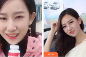 永州國(guó)斌口腔門診部唐穎文整形價(jià)格表附牙齒隱形矯正案例展示