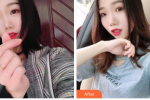 天水退休專家醫(yī)院醫(yī)療美容科杜海英整形價(jià)格表附牙齒隱形矯正案例展示