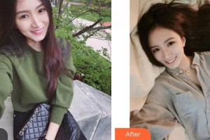 銀川愛美麗醫(yī)療美容門診部范元濤整形價(jià)格表附熱拉提案例展示