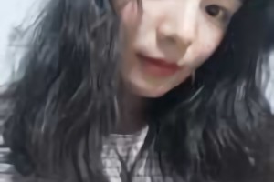 北京圣嘉榮醫(yī)療美容醫(yī)院磨骨好不好？附黃大勇磨骨案例