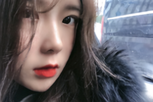 沈陽杏林整形醫(yī)院朱石江頜面手術(shù)果好不好附果分享