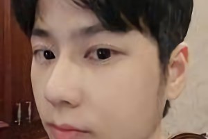 暨南大學(xué)附屬深圳華僑醫(yī)院季如恭下頜角整形怎么樣？附術(shù)后對(duì)比圖