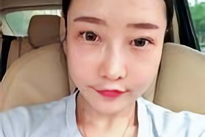 華西口腔醫(yī)院李運峰磨骨手術價格貴嗎？附價格表和案例