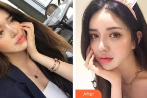 中國醫(yī)學(xué)科學(xué)院整形外科醫(yī)院馬繼光整形價(jià)格表附祛斑祛痣案例展示