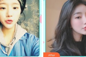 中國醫(yī)科大學(xué)航空總醫(yī)院疤痕修復(fù)科宋俊生整形價格表附光子嫩膚案例展示