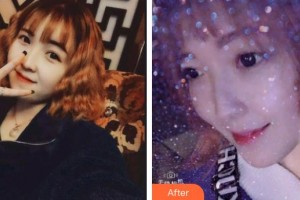 福清天寶美容醫(yī)院蔡黎光整形價(jià)格表附超聲波潔牙案例展示