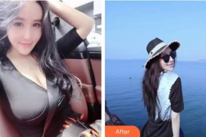 郴州現(xiàn)代女子醫(yī)院醫(yī)學(xué)整形中心顏嵐亭整形價(jià)格表附膨體隆鼻案例展示