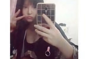 上海華美醫(yī)院李志海做的下頜角貴嗎？附案例日記分享