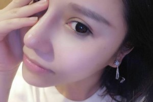 同濟大學(xué)附屬東方醫(yī)院醫(yī)生團隊如何？附隆鼻手術(shù)附果圖展示