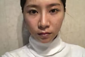 上海仁愛(ài)醫(yī)院劉先超磨骨怎么樣？附案例分享和較新價(jià)格表