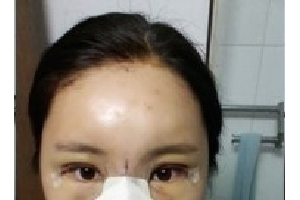 上海大附屬九院整形科如何？附實拍案例+醫(yī)生介紹