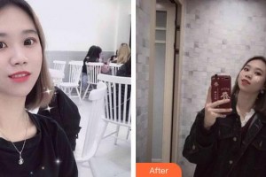 郴州瑞瀾醫(yī)療美容醫(yī)院黃敏建整形價(jià)格表附清潔祛痘案例展示