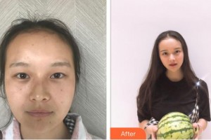 樂清開發(fā)區(qū)醫(yī)院眼科湯晉魏整形價格表附眼部綜合案例展示