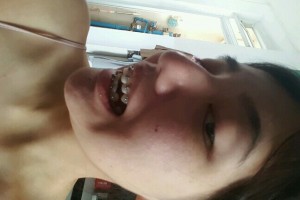 歡樂(lè)口腔醫(yī)院孫延牙齒矯正？醫(yī)生推薦+費(fèi)用表