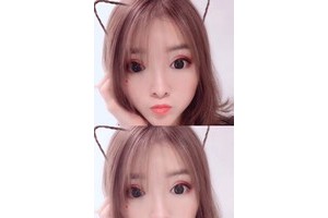 鄭州天后整形醫(yī)院割雙眼皮貴不貴附價(jià)格一覽