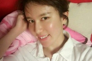 北京同仁醫(yī)院牙齒矯正貴不貴附案例和價(jià)格表