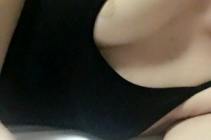 西安畫(huà)美醫(yī)療美容醫(yī)院硬件設(shè)施怎么樣芮浩隆胸手術(shù)附果圖