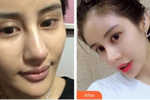 黃河中心醫(yī)院整形美容中心王磊整形價格表附鼻部綜合案例展示