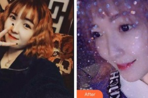 西昌口腔醫(yī)院王秀華整形價(jià)格表附超聲波潔牙案例展示