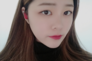 杭州時(shí)光醫(yī)療美容醫(yī)院河?xùn)|鎬醫(yī)生怎么樣？附磨骨案例分享和價(jià)格表