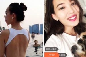 雞西王醫(yī)生整形外科門診部郝國梁整形價(jià)格表附牙齒陶瓷矯正案例展示