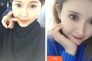 瑞安雅正口腔門診部吳奕坤整形價(jià)格表附牙齒陶瓷矯正案例展示