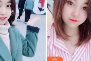 惠陽(yáng)長(zhǎng)安醫(yī)院整形美容中心鄒海昌整形價(jià)格表附耳軟骨復(fù)合隆鼻案例展示