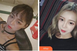 濟源尖峰眼科醫(yī)院胡成功整形價格表附眼部綜合案例展示