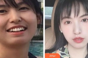 濟源霍氏口腔醫(yī)院霍文靜整形價格表附美白貼片案例展示