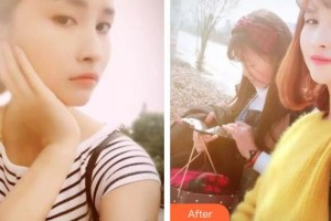 濟源霍氏口腔醫(yī)院石明軍整形價格表附美白劑美白牙齒案例展示