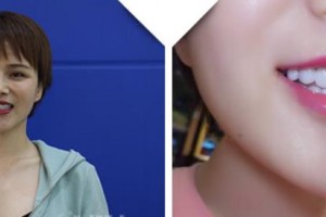 大理麗顏醫(yī)學整形美容診所陳方中整形價格表附牙貼面案例展示