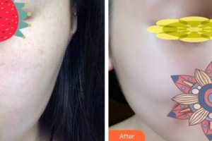 大理麗顏醫(yī)學整形美容診所楊成整形價格表附補水保濕案例展示