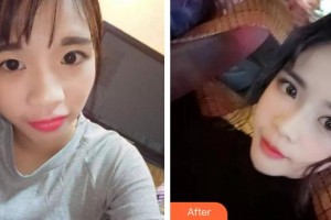 大理韓美醫(yī)療美容醫(yī)院李建剛整形價(jià)格表附無針?biāo)獍咐故?>
</a>
<h3 class=