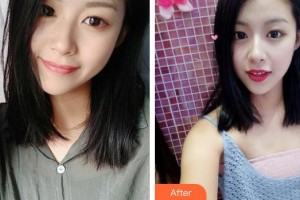 唐河?xùn)|方眼科醫(yī)院李斌整形價(jià)格表附切開雙眼皮案例展示